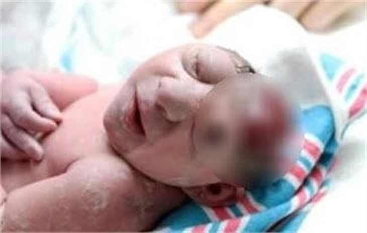 Facebook'un sansürlediği fotoğraflar