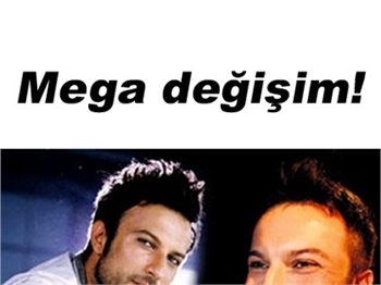 TARKAN'A 'ELMACIK KEMİĞİ' ESTETİĞİ!