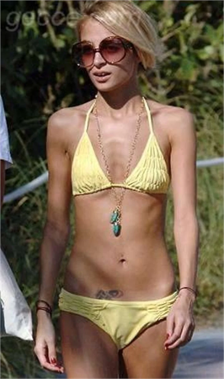 Nicole richie´nin değişimi!