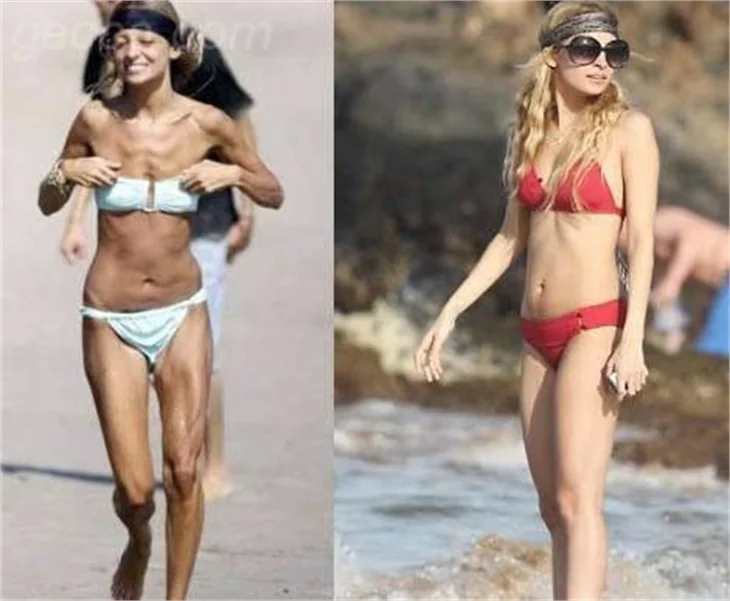 Nicole richie´nin değişimi!