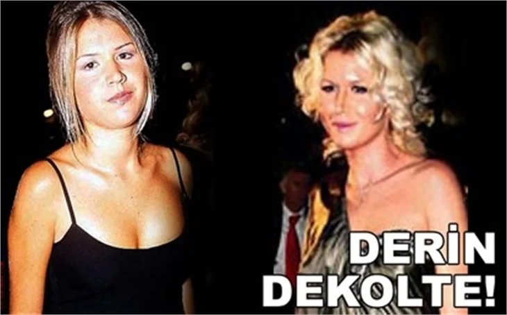 DERİN DEKOLTE
