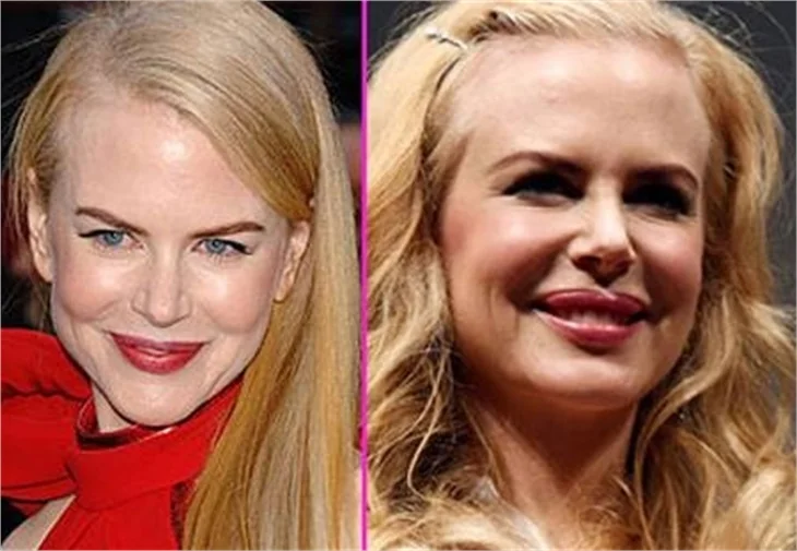 NICOLE KIDMAN BOTOKS KURBANI!