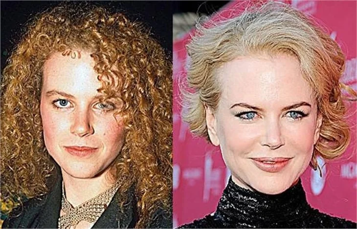 NICOLE KIDMAN BOTOKS KURBANI!