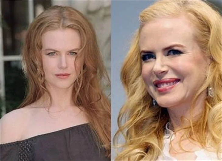 NICOLE KIDMAN BOTOKS KURBANI!