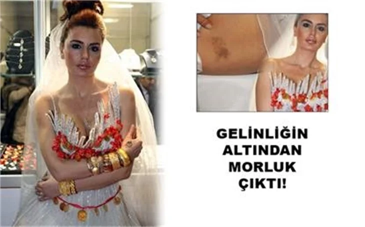 DAYAK MI ESTETİK Mİ?