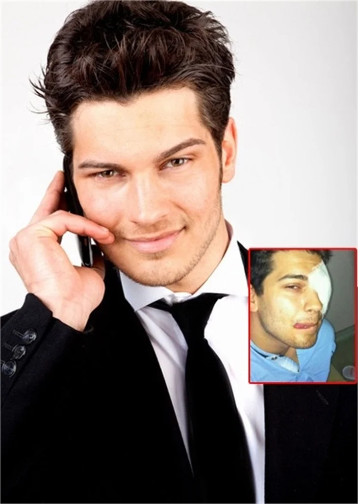 ÇAĞATAY ULUSOY AMELİYAT OLDU!