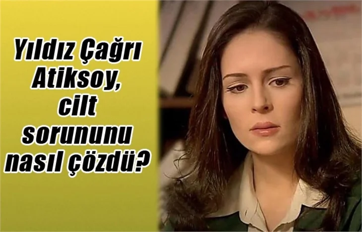 Yıldız Çağrı Atiksoy, cilt sorununu nasıl çözdü?