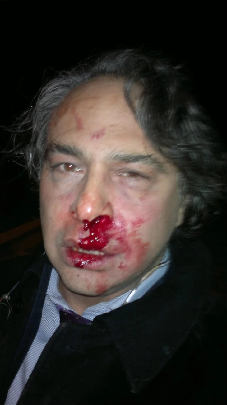 Barbaros Şansal'a saldırı anı güvenlik kamerasında!