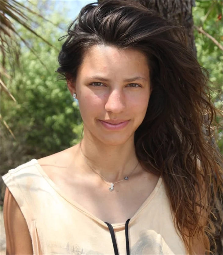 Survivor'da böyle değiştiler!