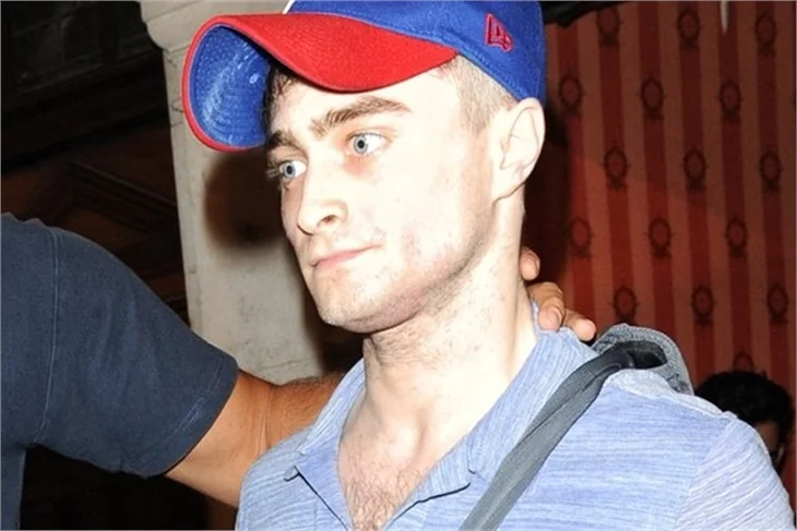 'Harry Potter' tanınmaz halde!