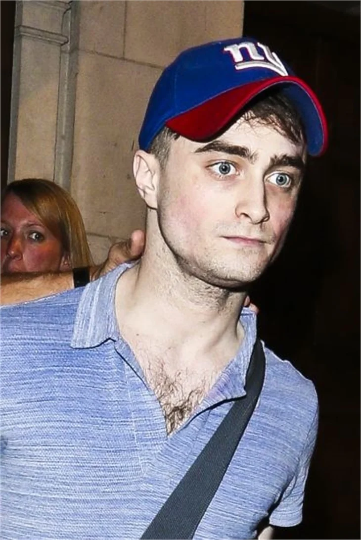 'Harry Potter' tanınmaz halde!
