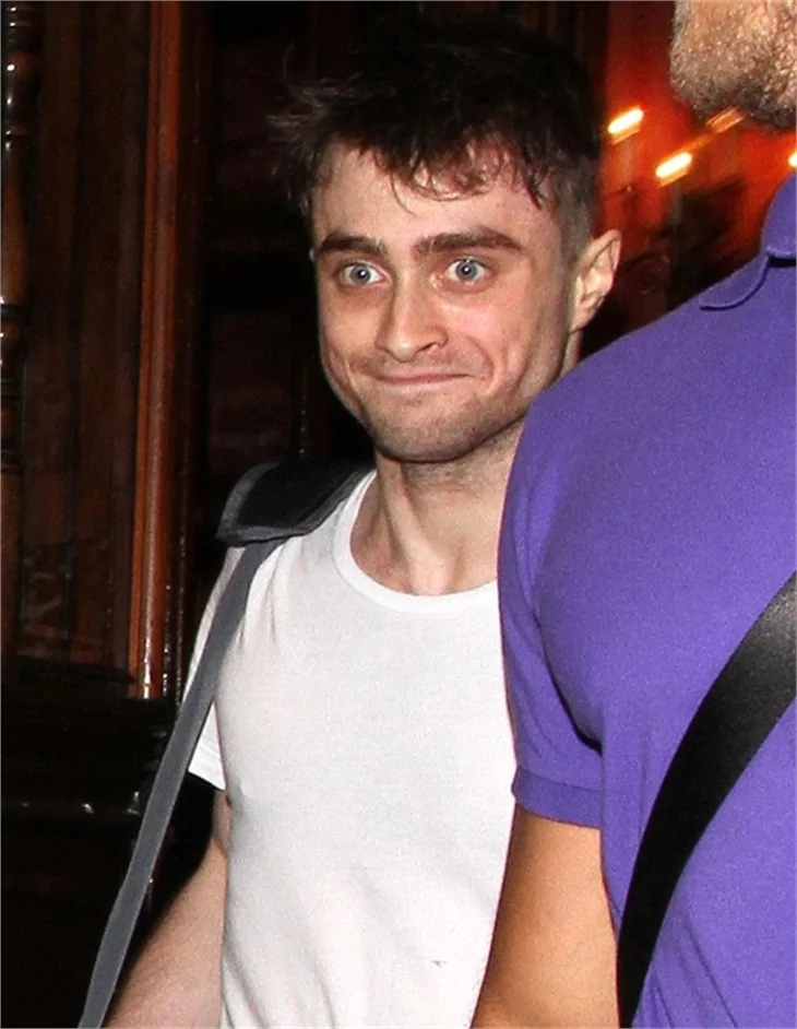 'Harry Potter' tanınmaz halde!