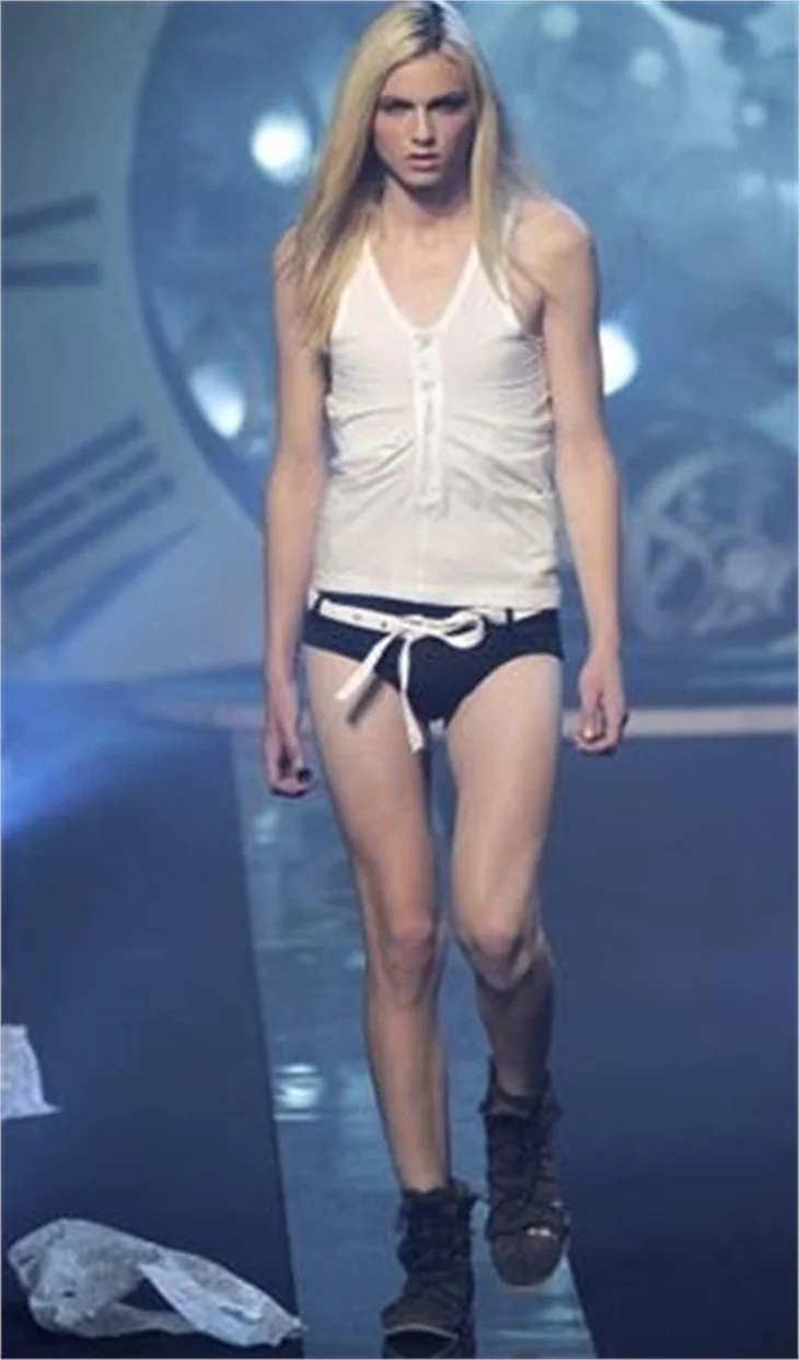 Androjen model attan düştü!