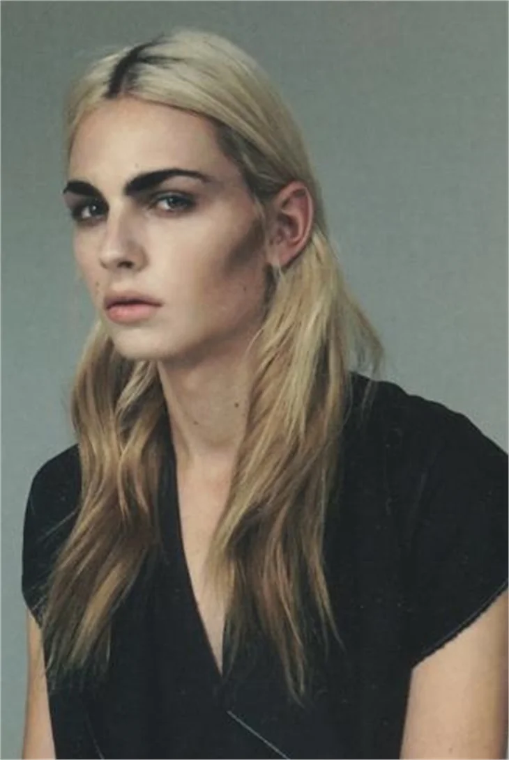 Androjen model attan düştü!