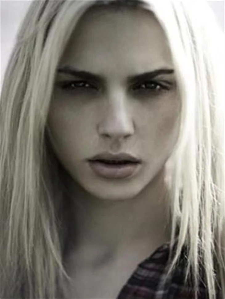 Androjen model attan düştü!