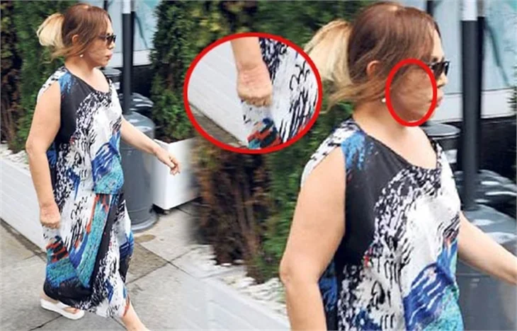 Sezen Aksu’nun hastalığı nüksetti!