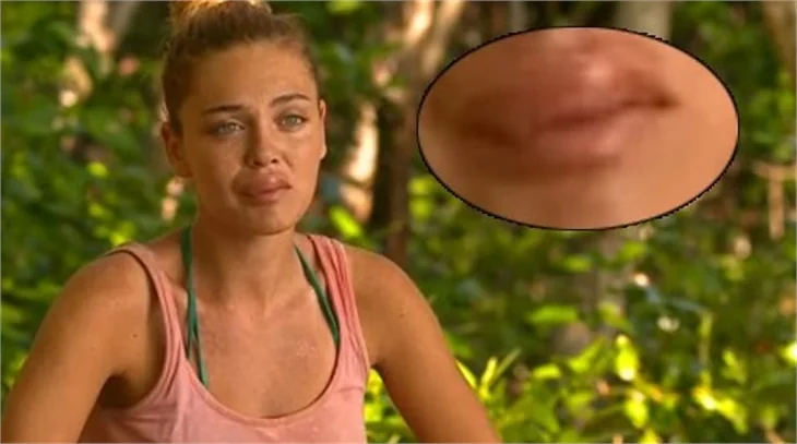 Survivor Müge tanınmayacak halde!