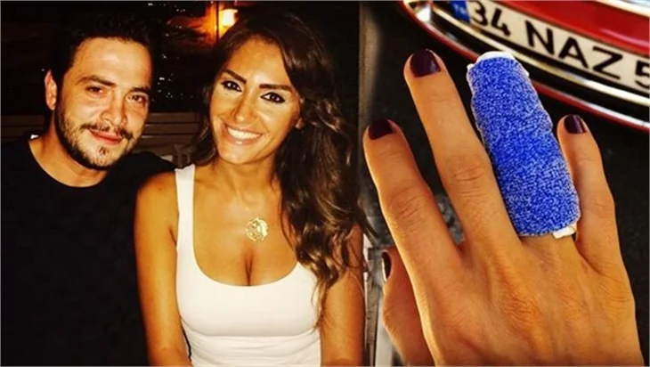 Naz Çekem: Ahmet Kural seviyorum deyip parmağımı kırdı