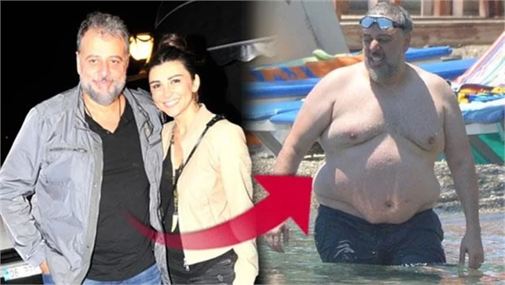 Hamdi Alkan ameliyat sonrası 20 kilo verdi