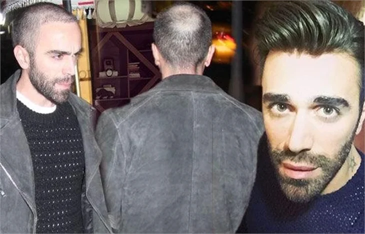 Kemal Doğulu'nun şaşırtan görüntüsü!