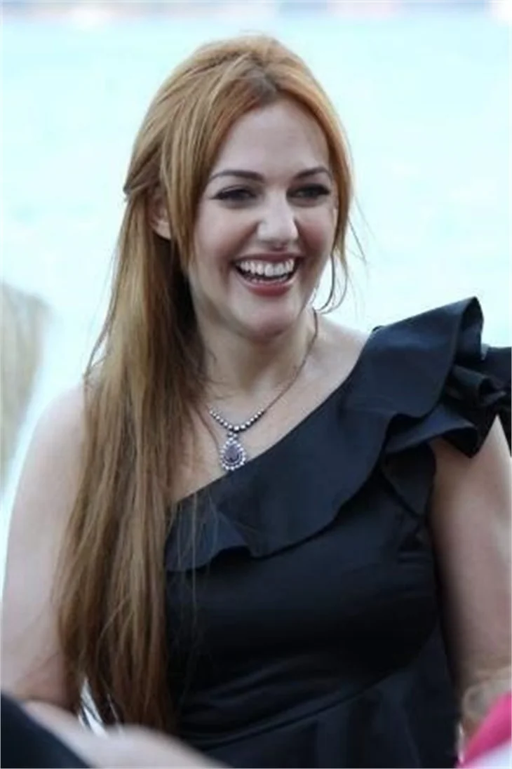 Meryem Uzerli'nin saçları yandı