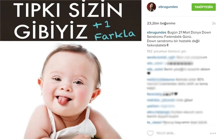 Ünlülerden 21 Mart Down Sendromu Farkındalık Günü paylaşımları!