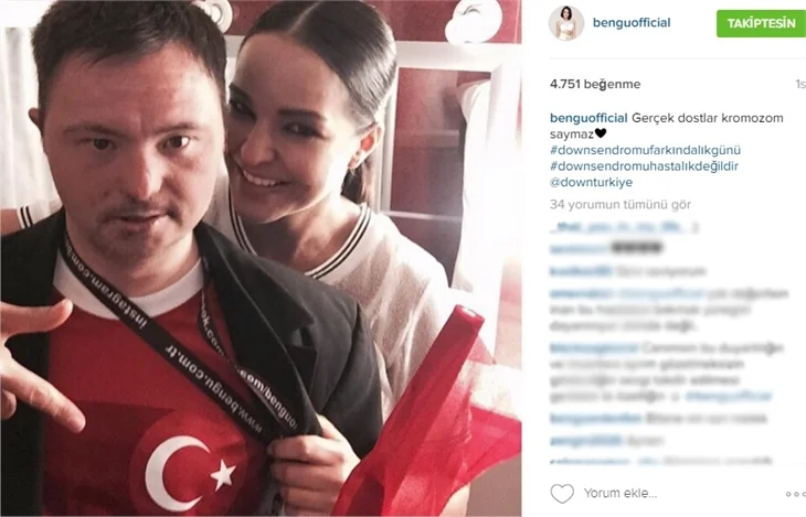Ünlülerden 21 Mart Down Sendromu Farkındalık Günü paylaşımları!