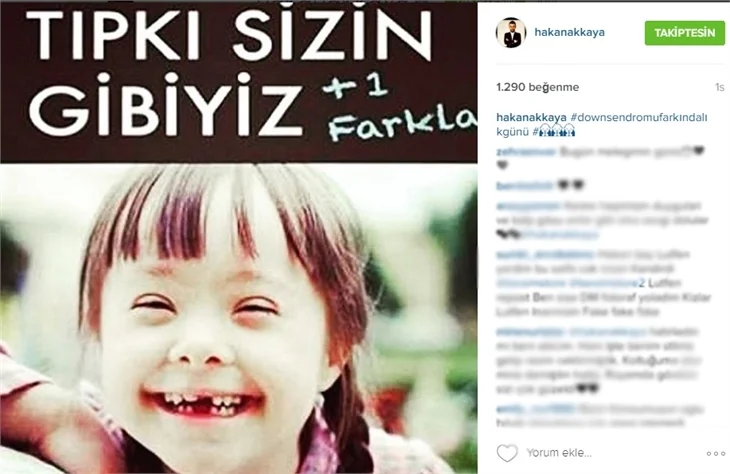 Ünlülerden 21 Mart Down Sendromu Farkındalık Günü paylaşımları!