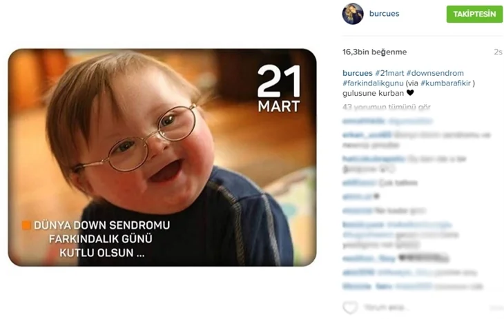 Ünlülerden 21 Mart Down Sendromu Farkındalık Günü paylaşımları!