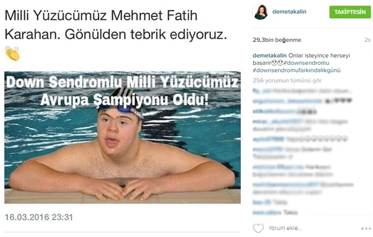 Ünlülerden 21 Mart Down Sendromu Farkındalık Günü paylaşımları!