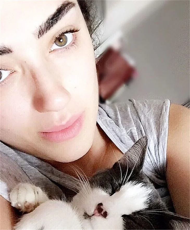 Dilan Çıtak burnunu yaptırdı