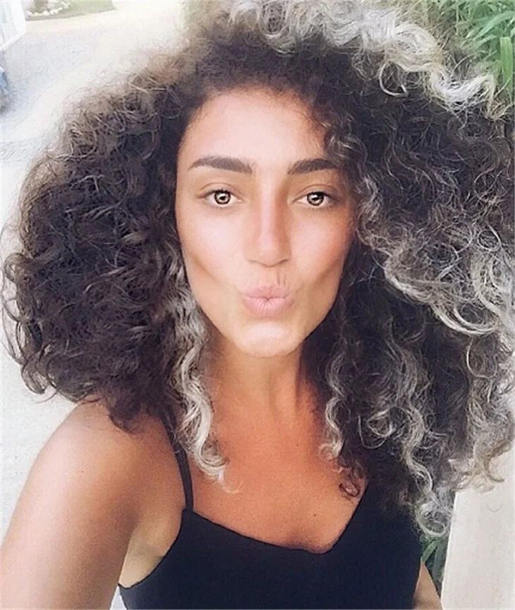 Dilan Çıtak burnunu yaptırdı