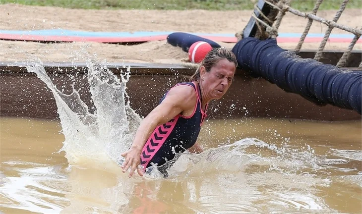 Survivor Nagihan Karadere, göğüs ve dudak estetiği oldu