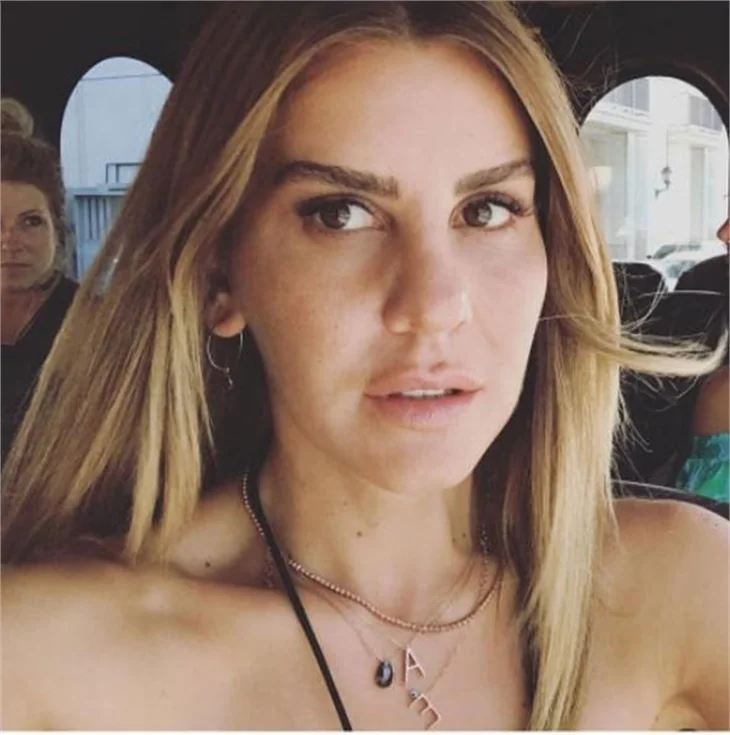 Eda Erol'un estetiksiz hali ortaya çıktı!