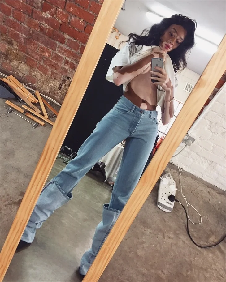Winnie Harlow hastalığına böyle meydan okuyor!