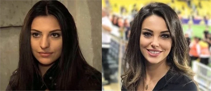 Tuvana Türkay ve Alper Potuk'un estetiksiz hali şaşırttı!