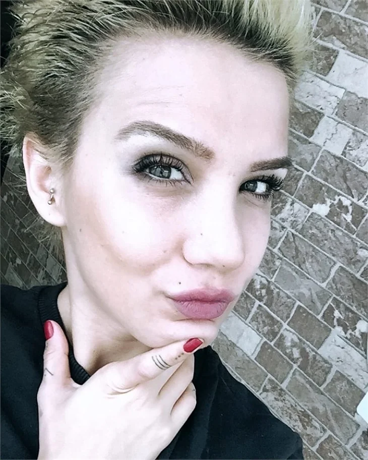 Survivor Elif Şadoğlu’nun son hali herkesi şaşırttı!
