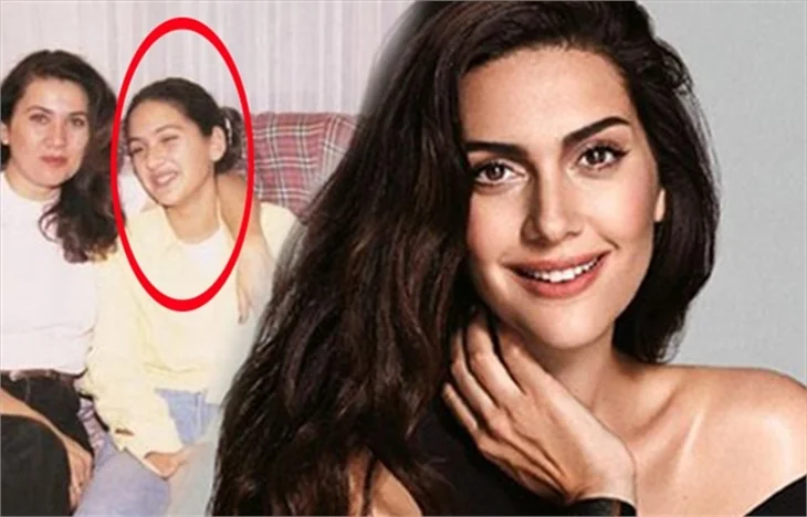 Bergüzar Korel'in küçüklük fotoğrafı şaşırttı!