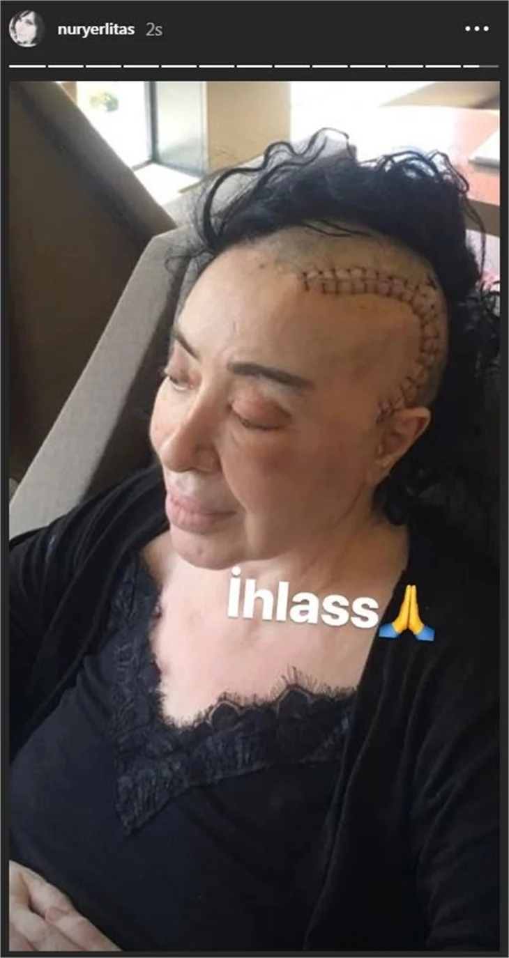 Nur Yerlitaş son halini paylaştı!