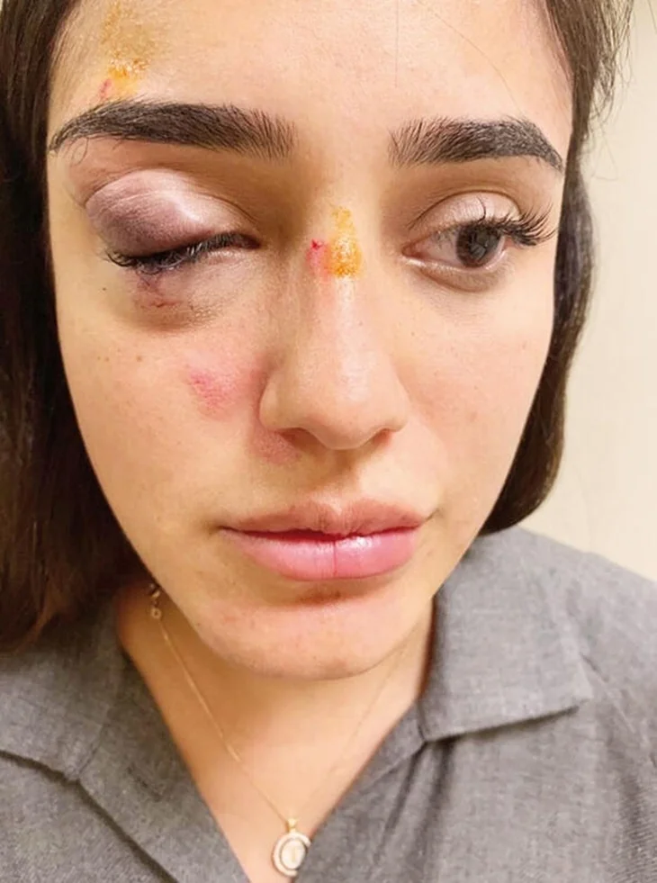Ceren Kaplakarslan'ın babası canlı yayında konuştu! "O bebeği..."