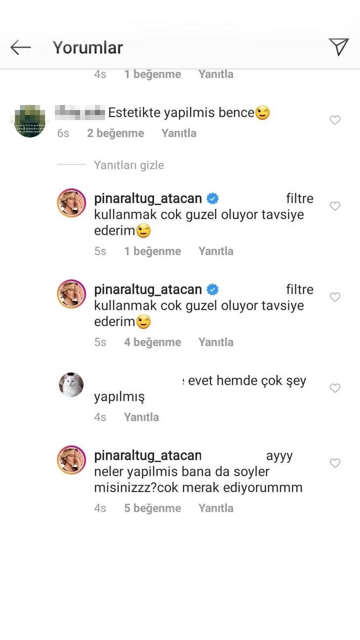 Pınar Altuğ'u yine çileden çıkardılar!