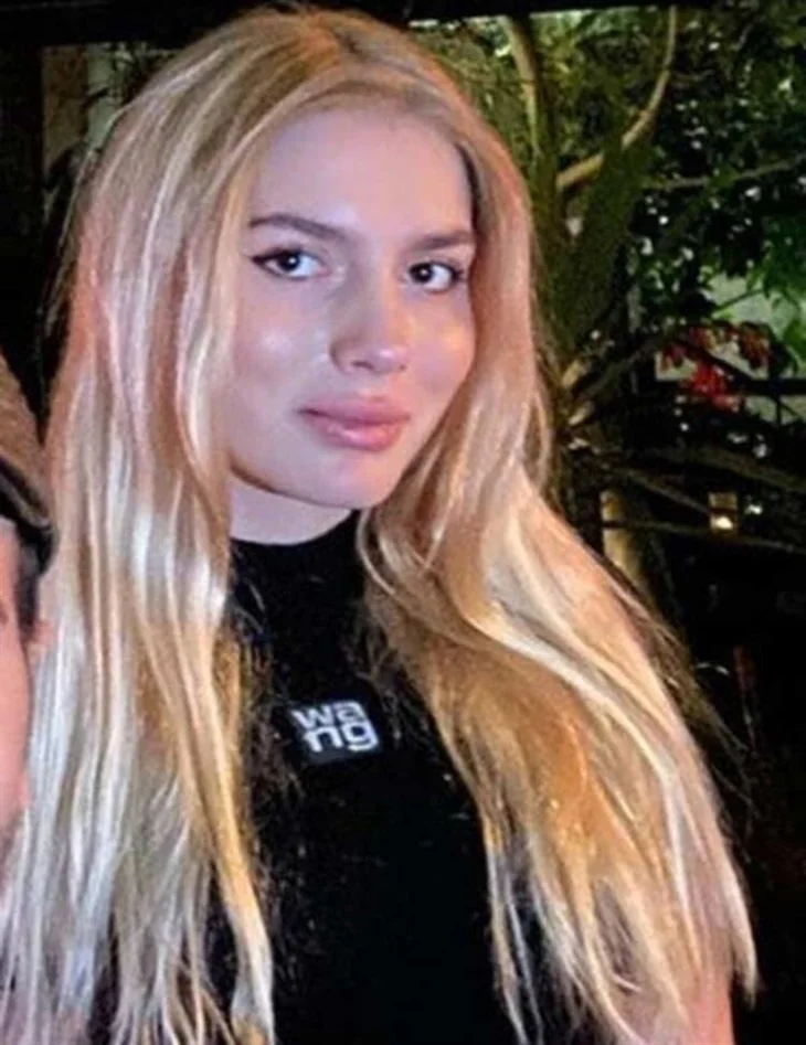 Aleyna Tilki'nin dudakları nasıl şişti?