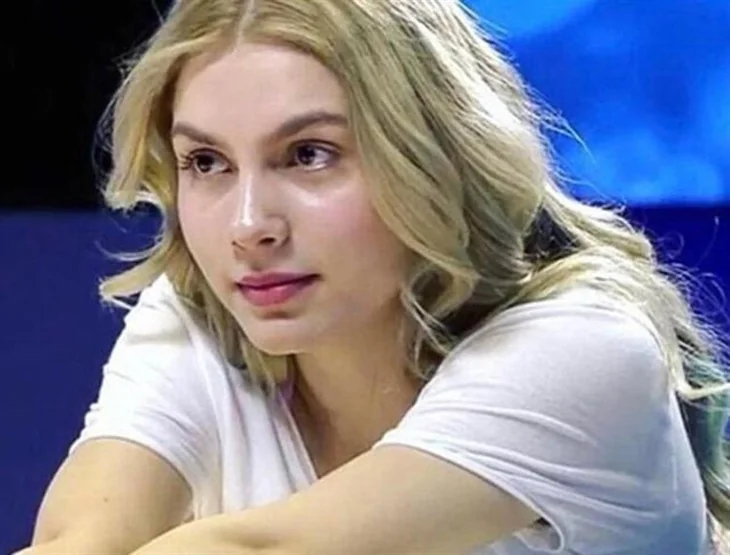 Aleyna Tilki'nin dudakları nasıl şişti?