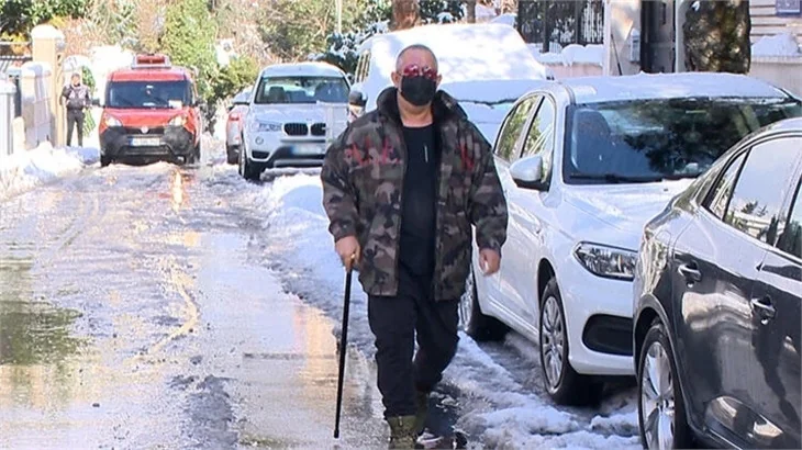 Bastonlu Cem Yılmaz!
