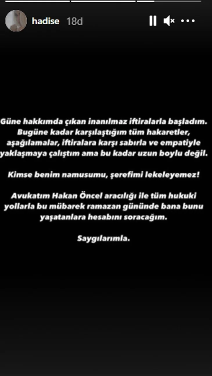 Hadise'den iddialar sonrası ilk açıklama!