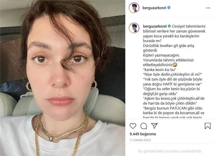 Bergüzar Korel: Burnum eski haline dönecek mi?