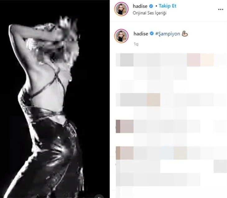 Hadise sahne dansıyla olay oldu! Sosyal medyayı salladı