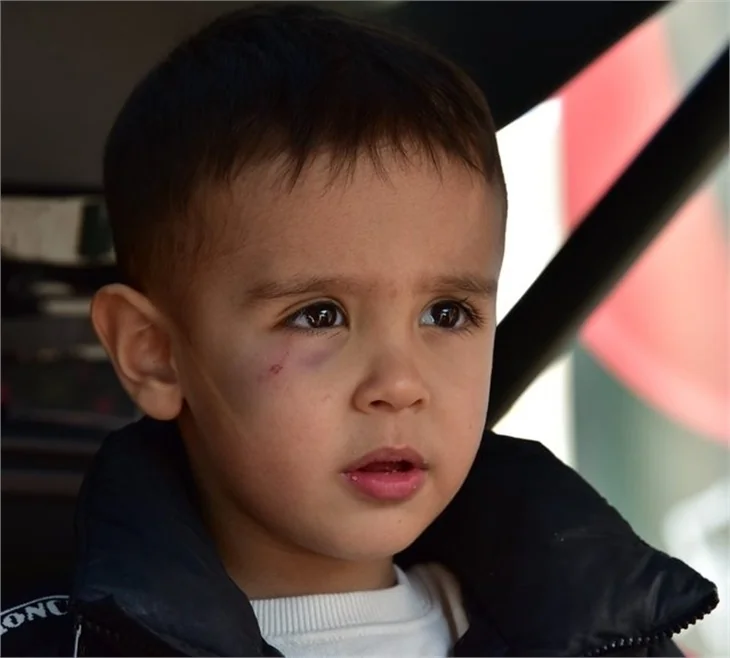 Burak’ın görünmez kazası! Alişan oğlu ve kızıyla görüntülendi