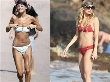 Nicole richie´nin değişimi!