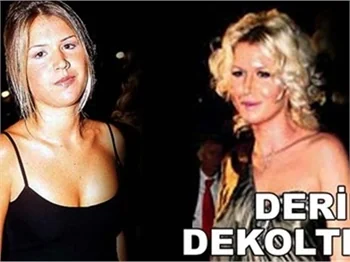 DERİN DEKOLTE